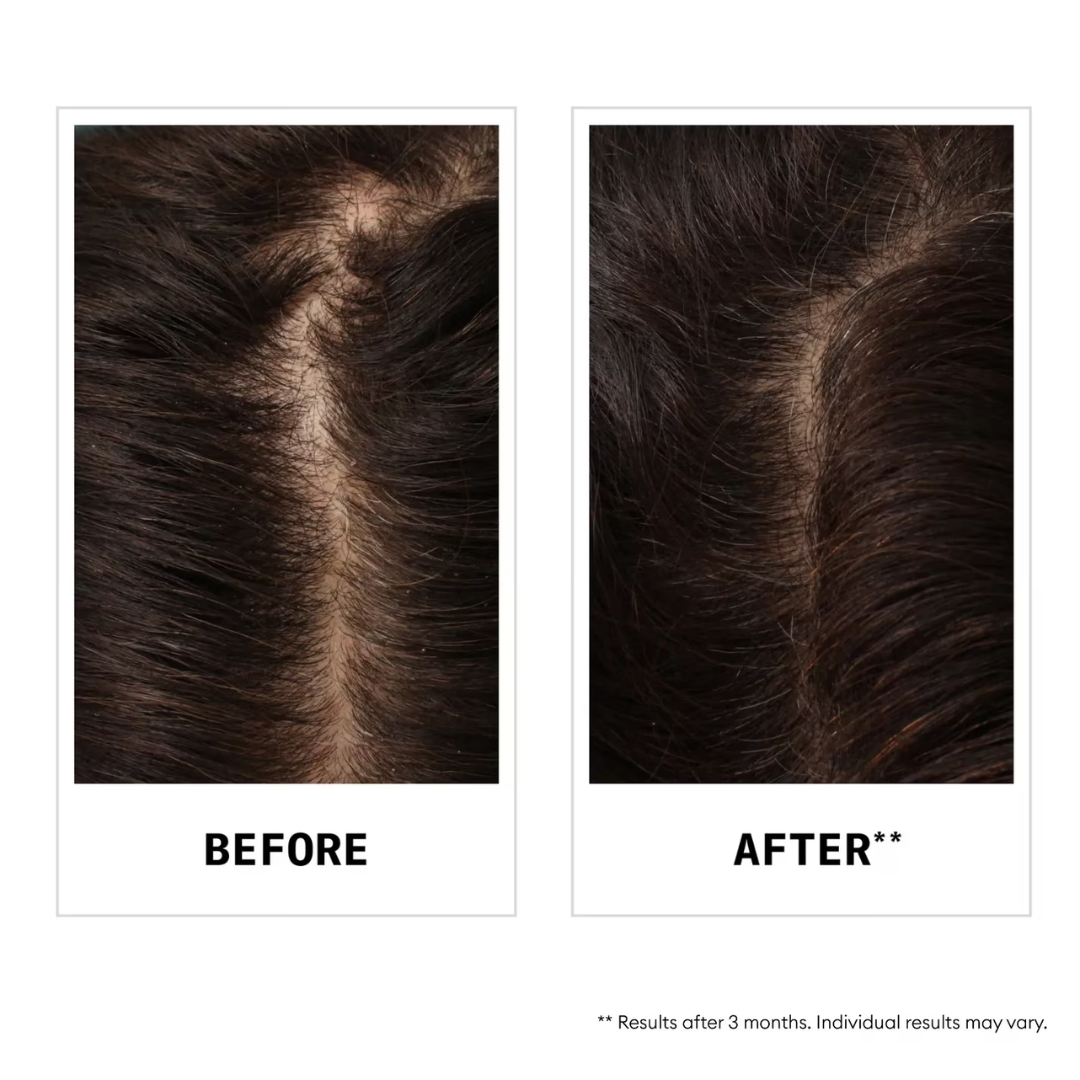 Nioxin Hair Fall Defense Shampoo